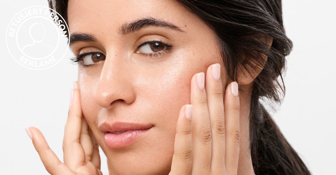 Causes Dark Spots 01 NO